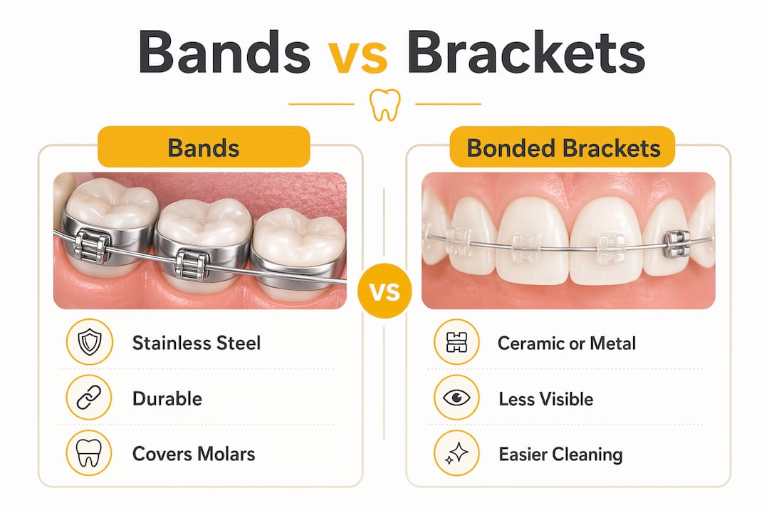 Infographic comparing orthodontic bands and brackets